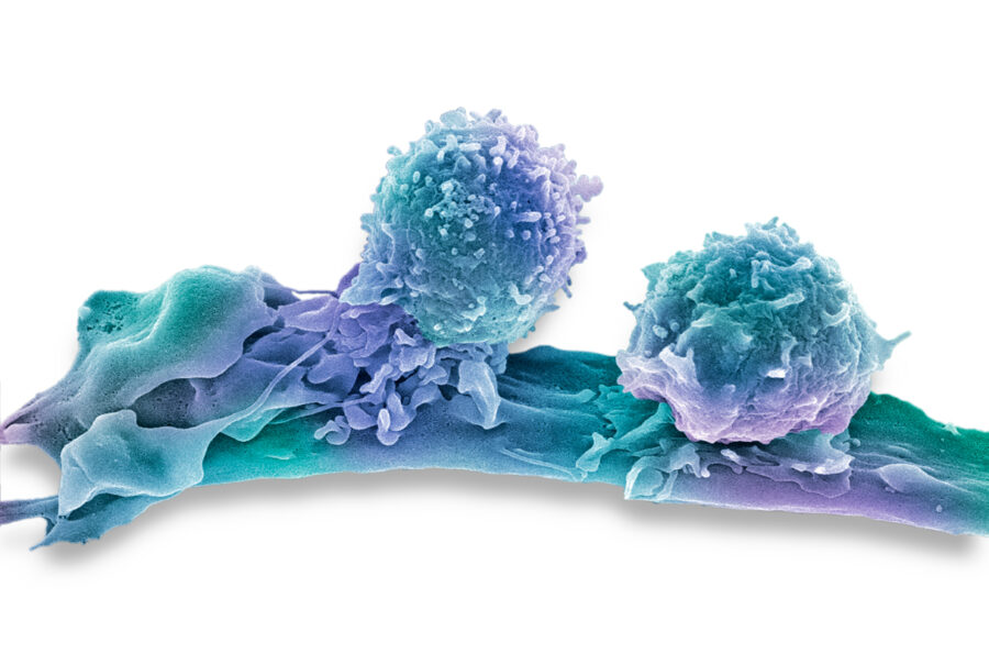 Iznenađujuća strategija: Borba sa mutiranim ćelijama raka pravljenjem više mutacija