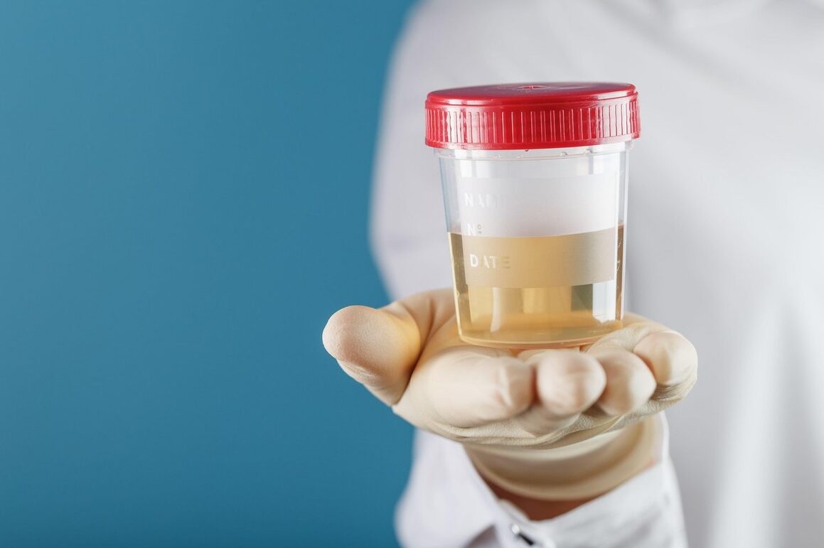 Na šta ukazuju povišeni leukociti u urinu